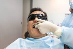 Dentist taking teeth imprint or impression of patient in dental clinic for a dental crown