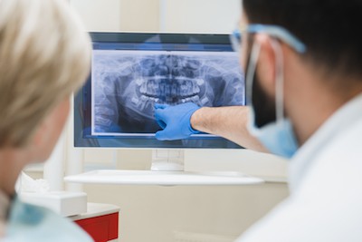 getting screened for periodontal disease by a dentist
