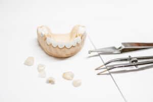 should i choose porcelain veneers or composite veneers