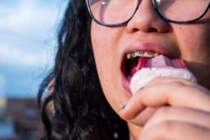 Tooth Pain Cold Sensitivity