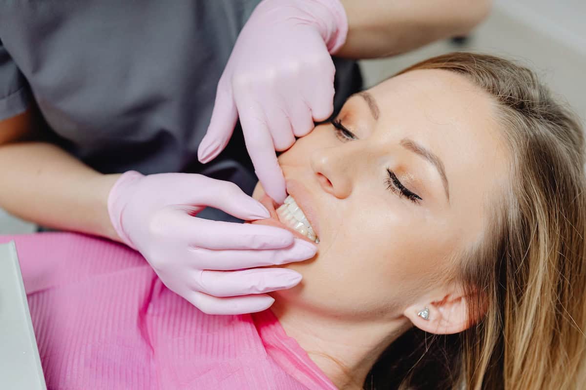 Teeth Whitening Consideration