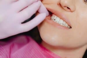 How to Stop Cavities