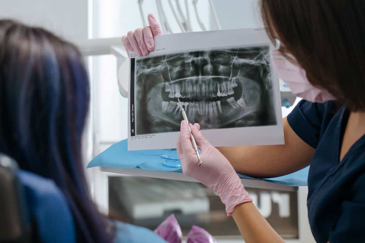 Early Signs of Tooth Decay