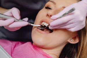 Early Signs of Tooth Decay