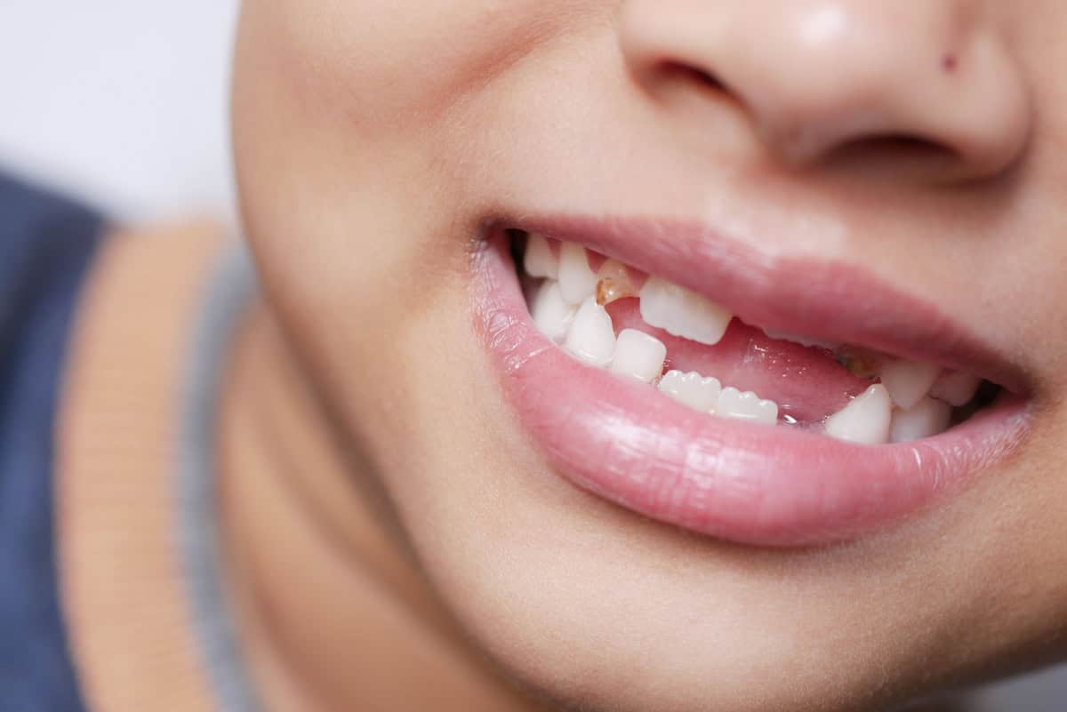 Oklahoma City Dental Emergency - Dentistry For You OKC | OKC Dentist Dental Emergency in Oklahoma City